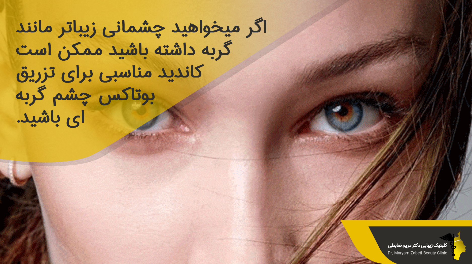 کاندیدای بوتاکس چشم گربه ای