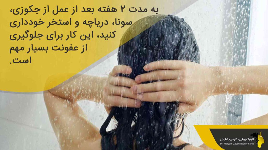 استحمام و قوانین آن بعد از عمل بلفاروپلاستی 