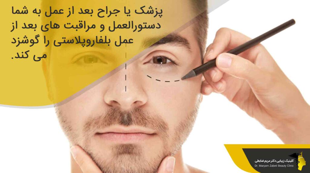 اهمیت مراقبت بعد از عمل بلفاروپلاستی
