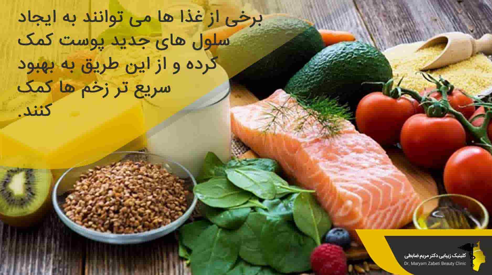 بعد از جراحی پلک چه غذاهایی باید خورد؟