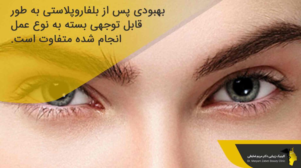 بهبودی بعد از عمل بلفاروپلاستی