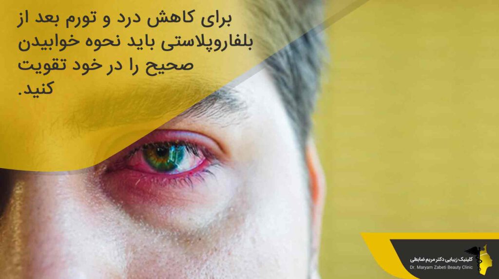 نحوه خوابیدن صحیح بعد از جراحی بلفاروپلاستی