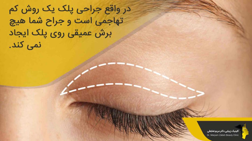 آیا عمل بلفاروپلاستی درد دارد؟