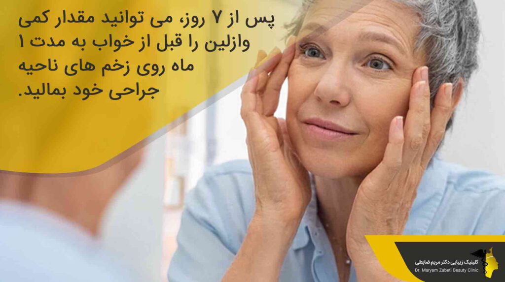 مصرف داروهای لازم بعد از عمل بلفاروپلاستی 