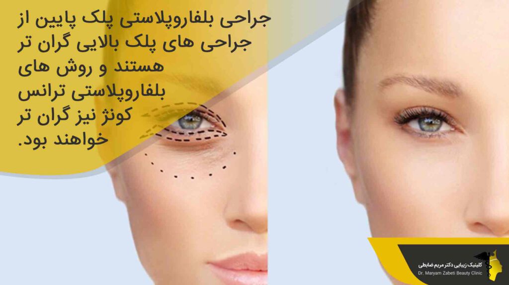 قیمت جراحی بلفاروپلاستی پلک پایین