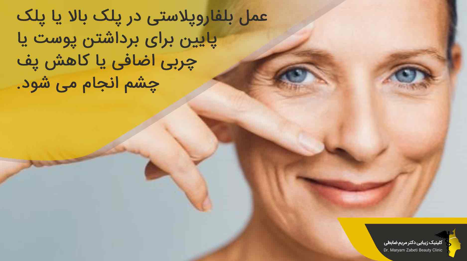 هزینه بلفاروپلاستی