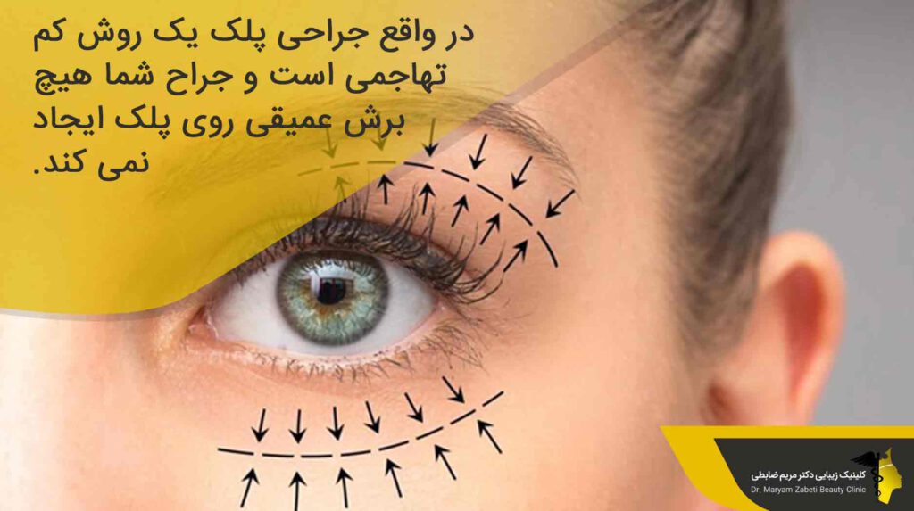 جلوگیری از درد در طول عمل بلفاروپلاستی