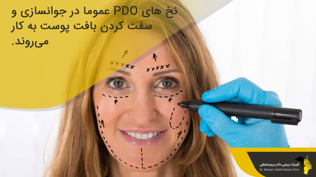 انواع نخ‌ها در لیفت صورت با نخ