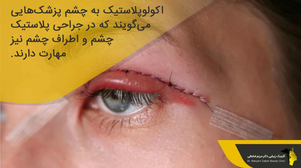 مراجعه به اکولوپلاستیک برای رعایت مراقبت های قبل از عمل بلفاروپلاستی