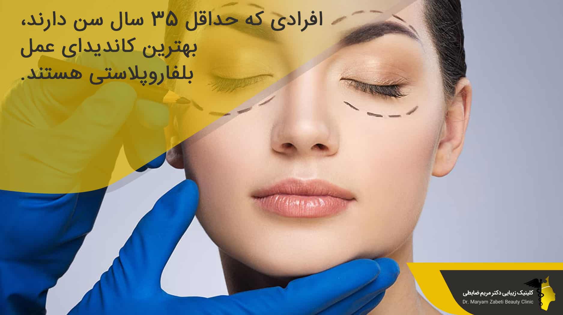 بهترین سن برای عمل بلفاروپلاستی