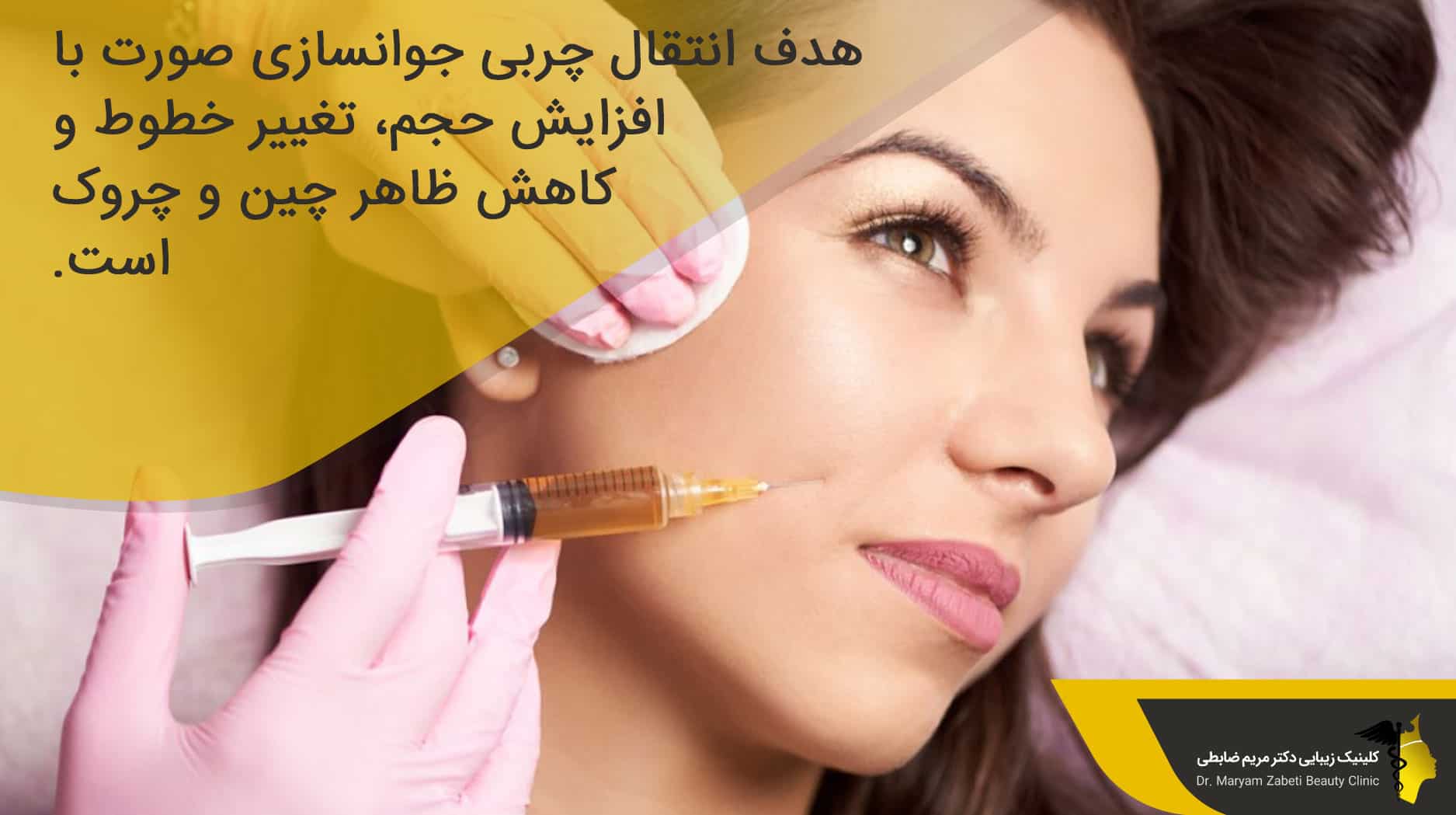 جوانسازی صورت با انتقال چربی چیست؟