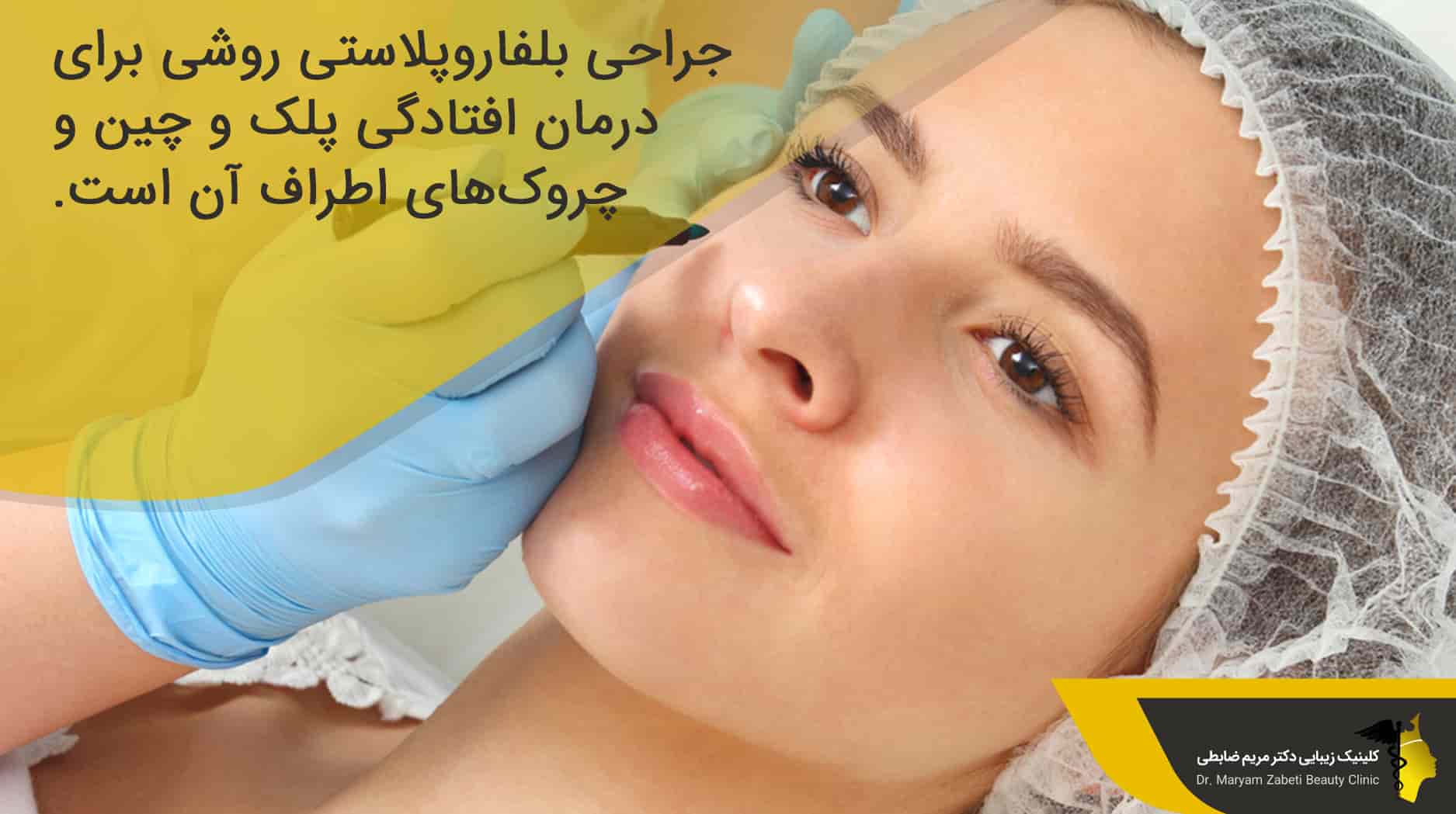 عمل بلفاروپلاستی چیست؟