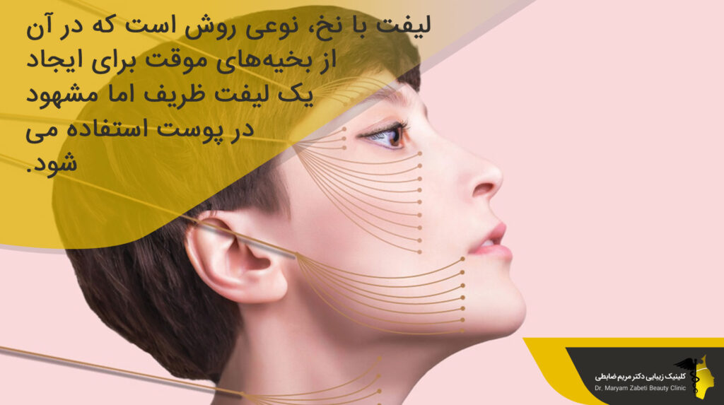 لیفت با نخ چیست؟