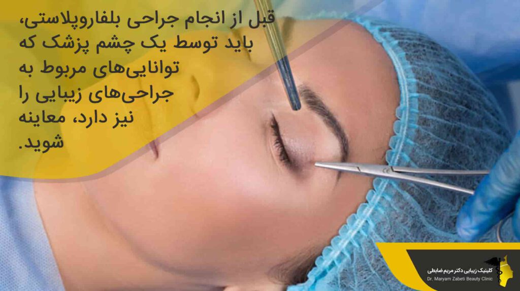 مراقبت‌های قبل از جراحی بلفاروپلاستی