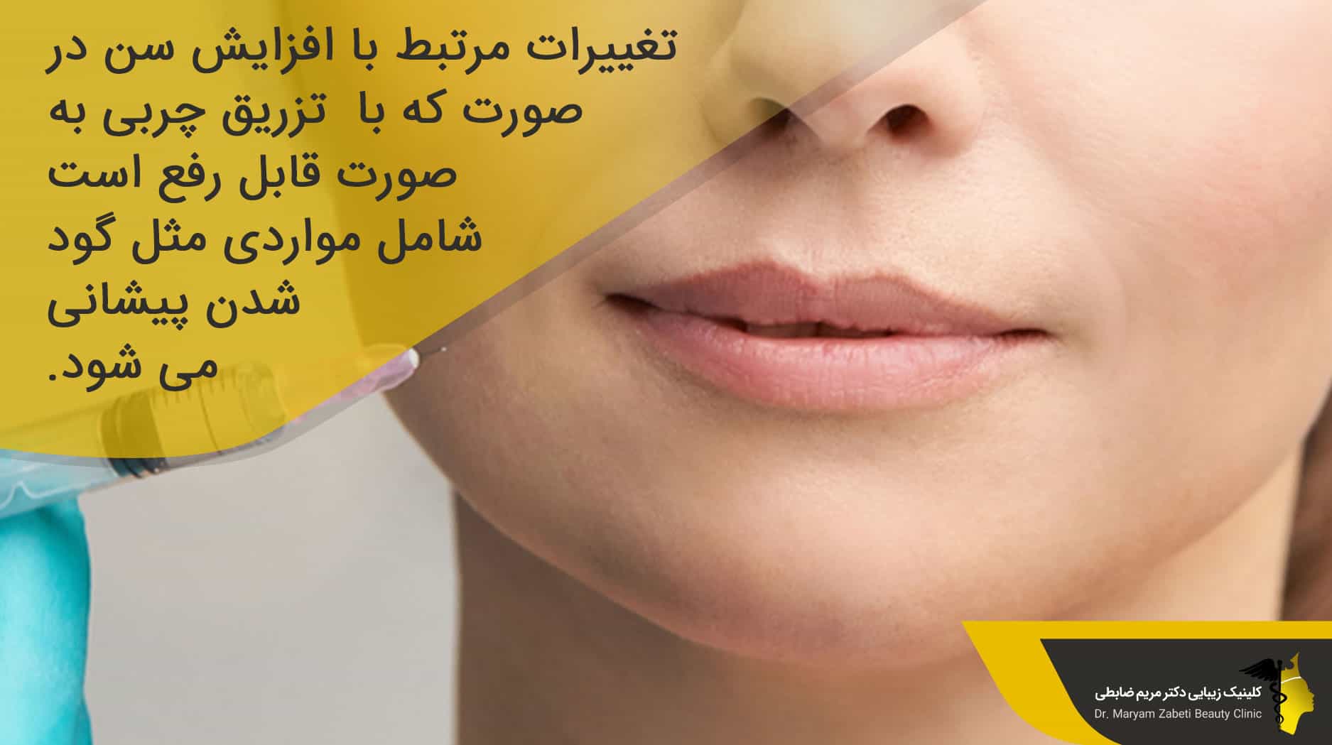 کدام یک از نشانه های پیری با پیوند چربی قابل درمان هستند؟