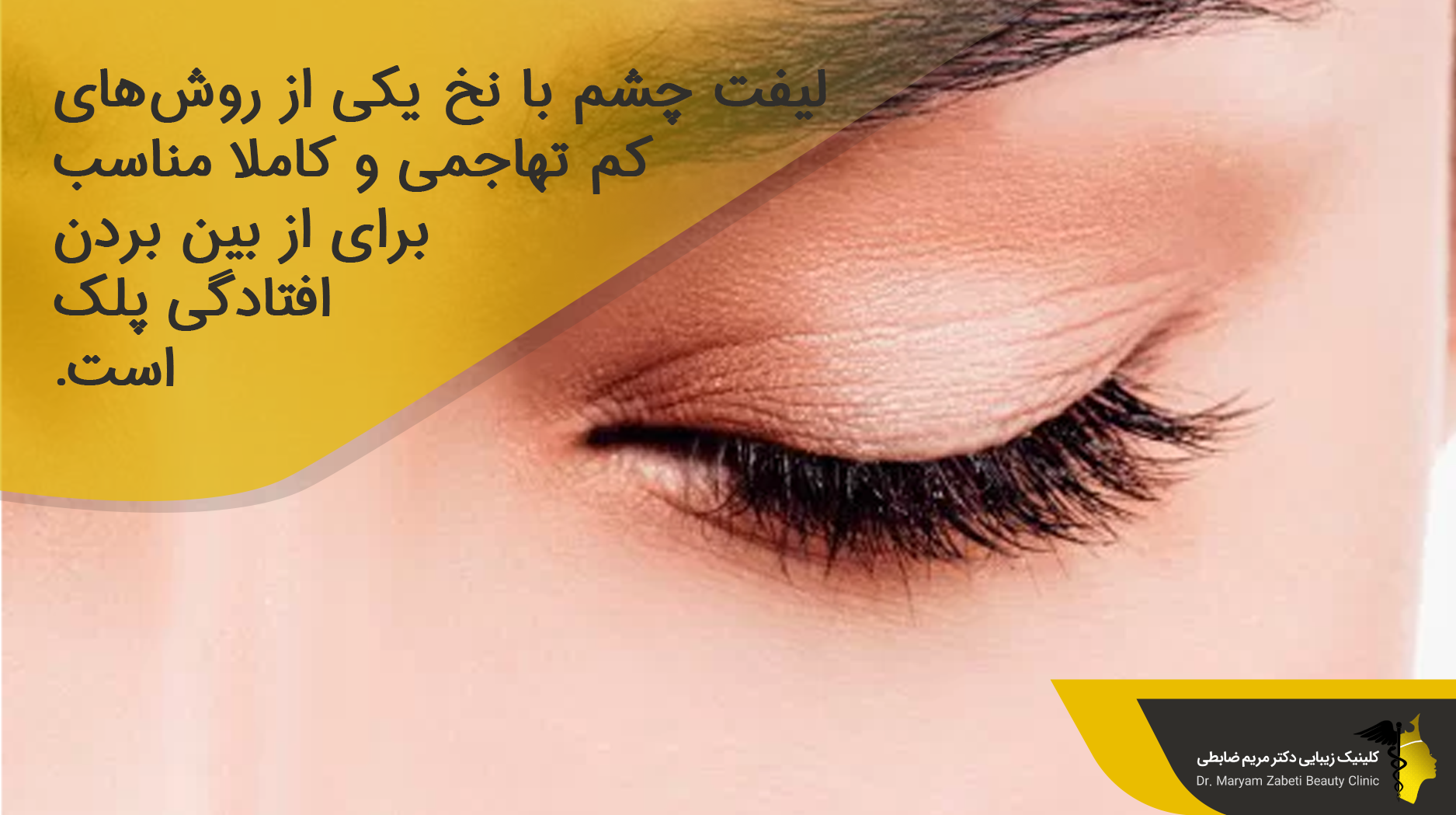 لیفت چشم با نخ 