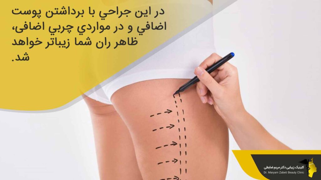 لیفت ران پا چیست؟