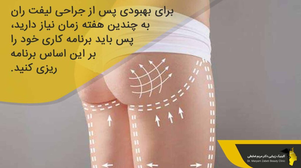 اقدامات بعد از لیفت ران 