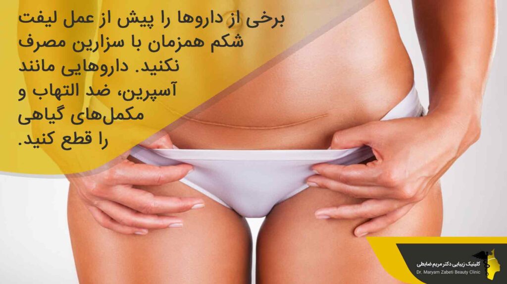 اقدامات لازم قبل از لیفت شکم همزمان با سزارین