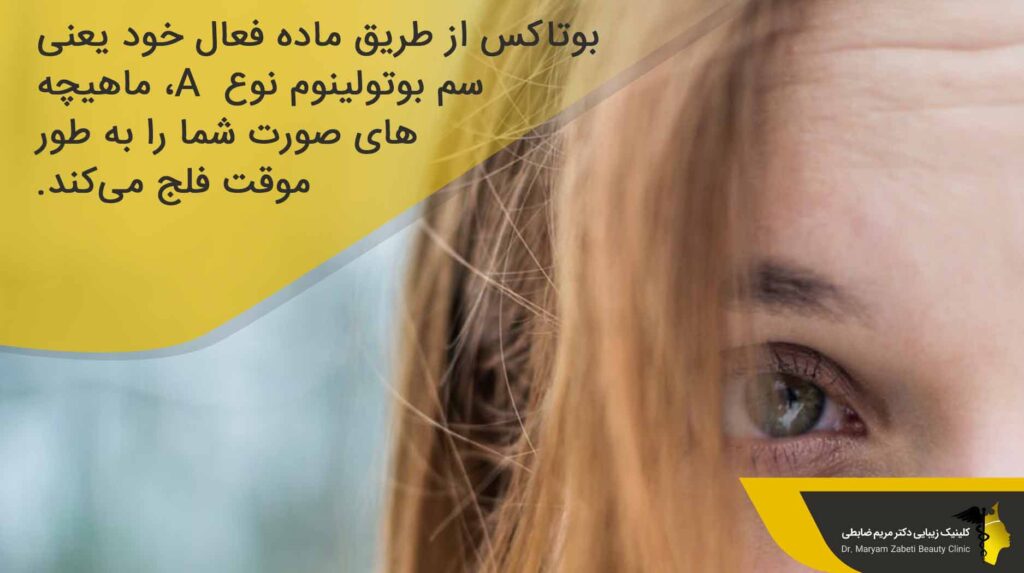بوتاکس پیشانی چیست؟