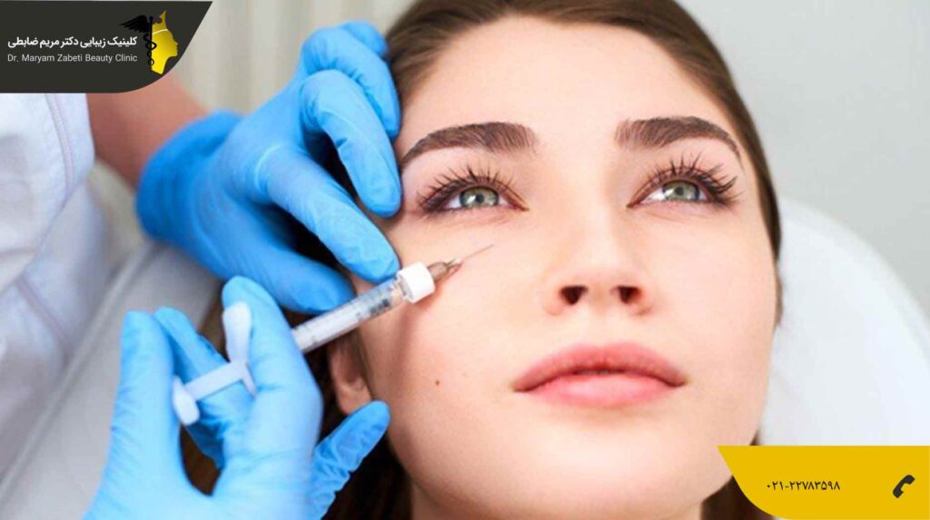 تزریق بوتاکس دور چشم، راهی باور نکردنی برای خلاصی از چین و چروک دور چشم