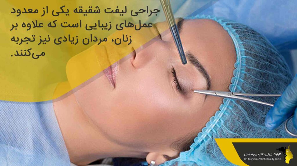 جراحی لیفت شقیقه چیست؟ 