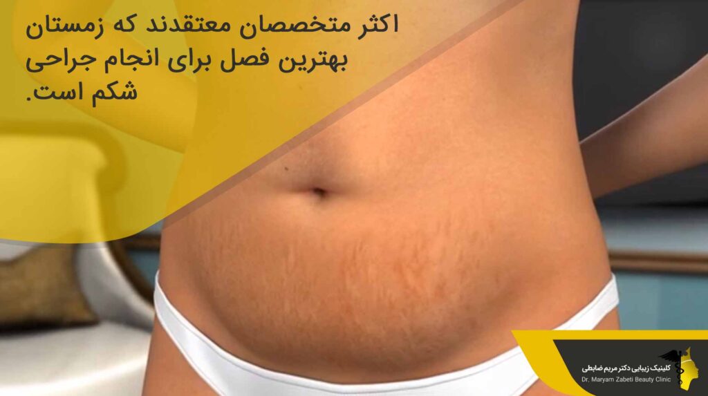 زمان مناسب برای جراحی شکم