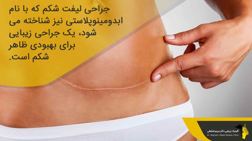 عمل لیفت شکم چیست؟