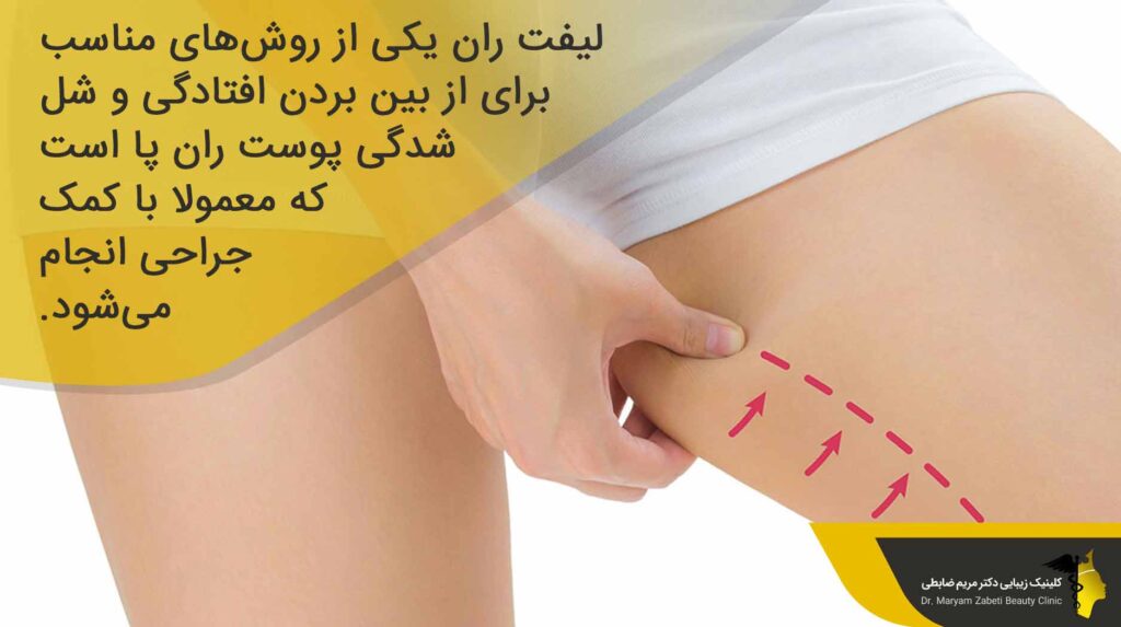 لیفت ران چیست؟