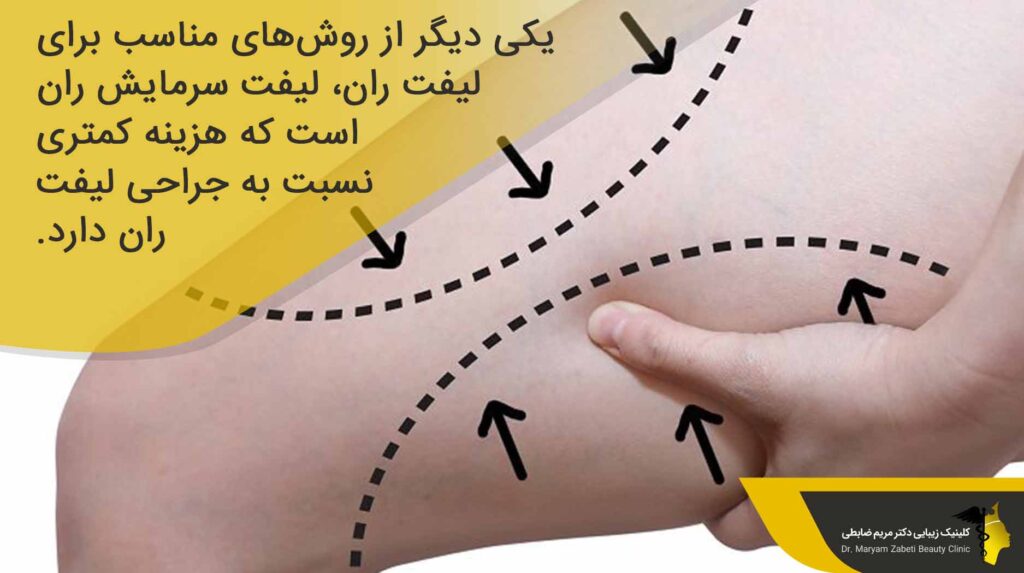 هزینه لیفت سرمایشی ران