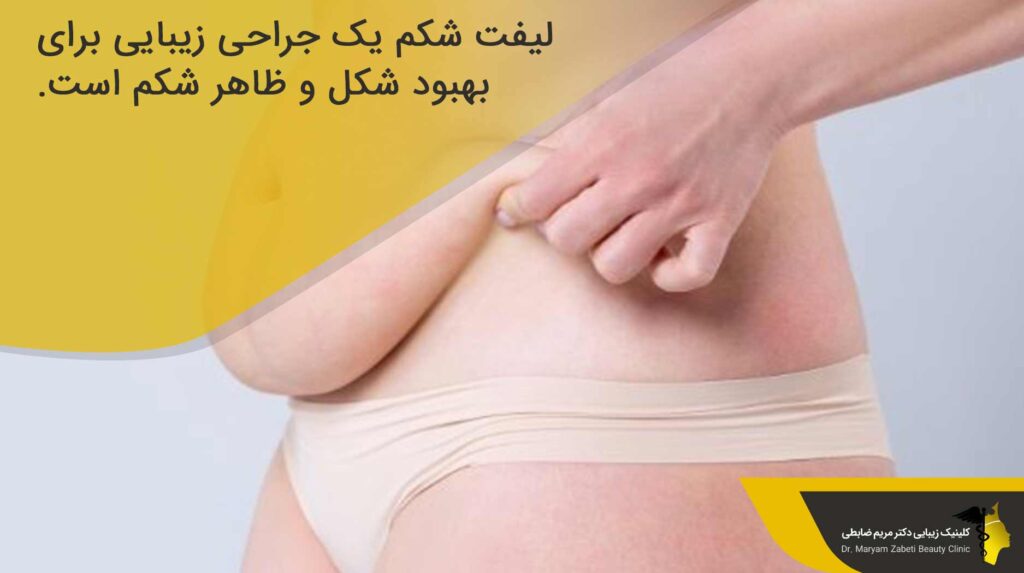 لیفت شکم چیست؟