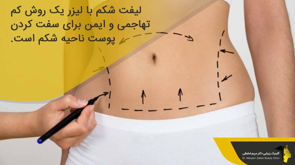 لیفت شکم با لیزر