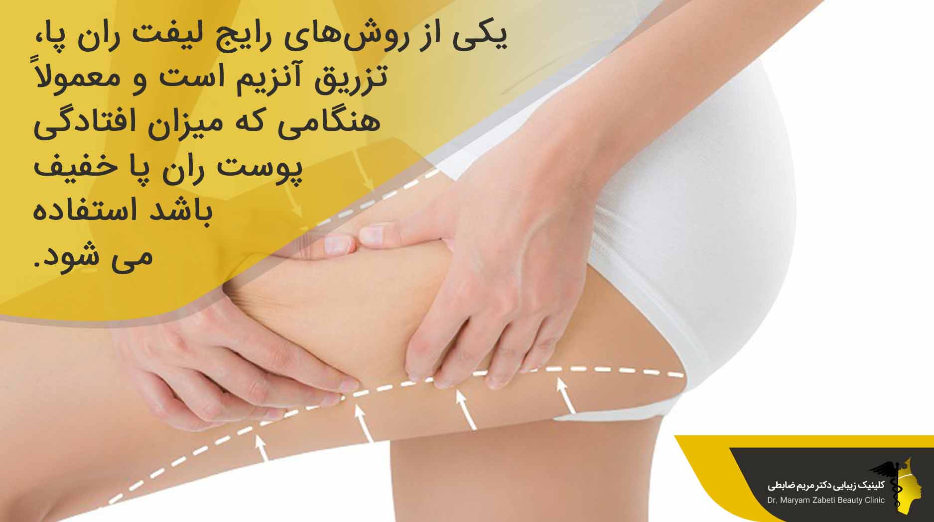 هزینه لیفت ران با روش مزوتراپی و تزریق آنزیم
