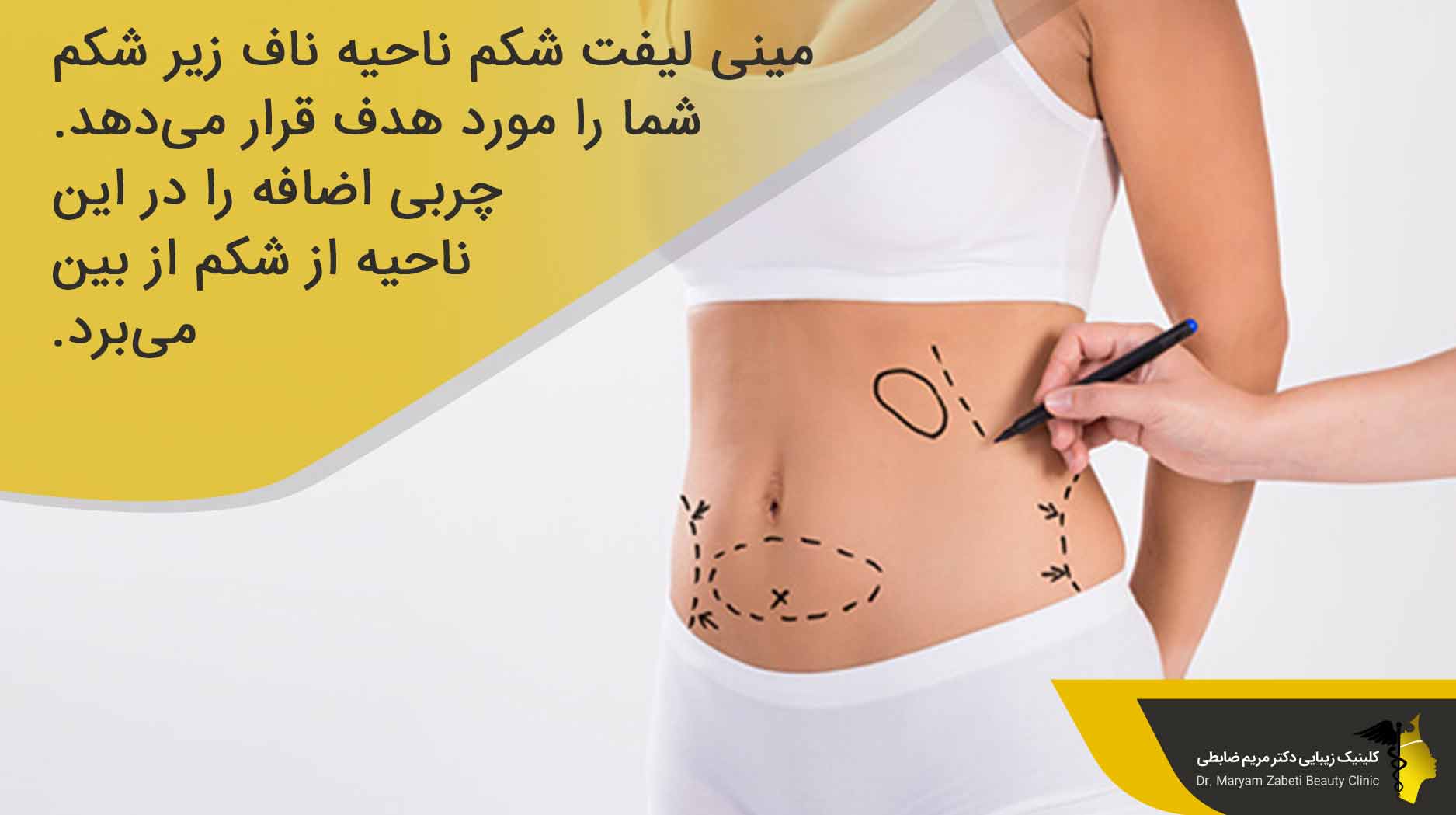 مینی لیفت شکم چیست؟