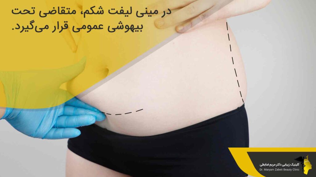 نوع بیهوشی در مینی لیفت شکم 