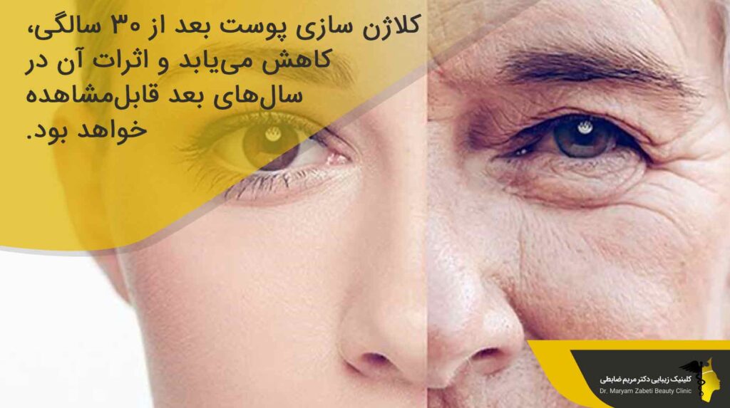 کلاژن سازی بیشتر مساوی با سلامتی بیشتر