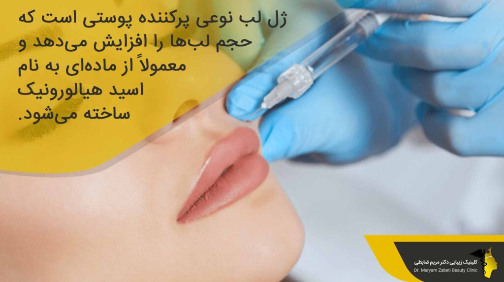 تزریق ژل لب طبیعی؛ روشی فوقالعاده برای فرم دهی و حجم دهی لب ها - مطب ...