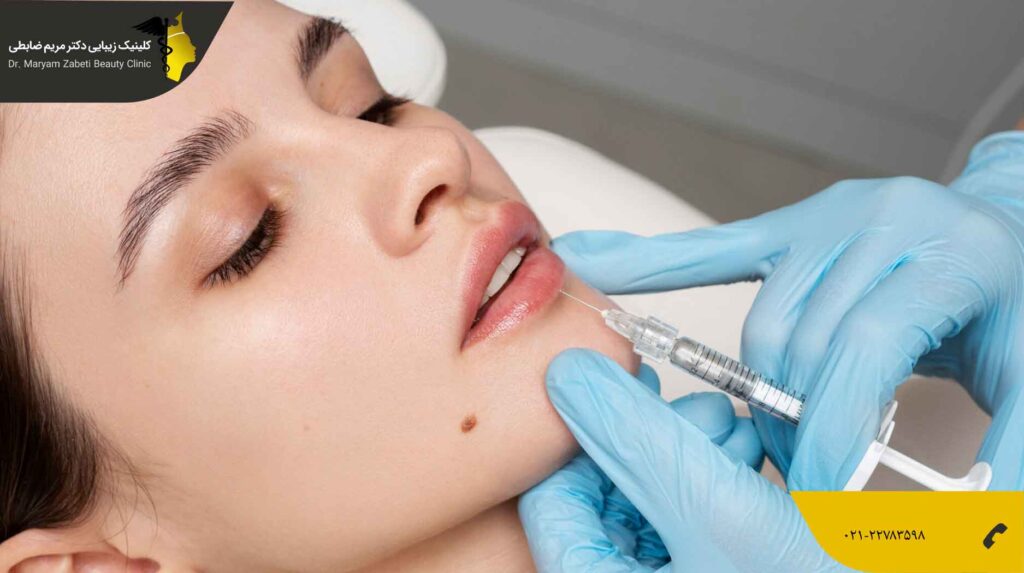 تزریق ژل لب طبیعی