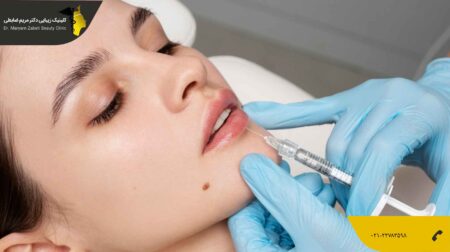 تزریق ژل لب طبیعی