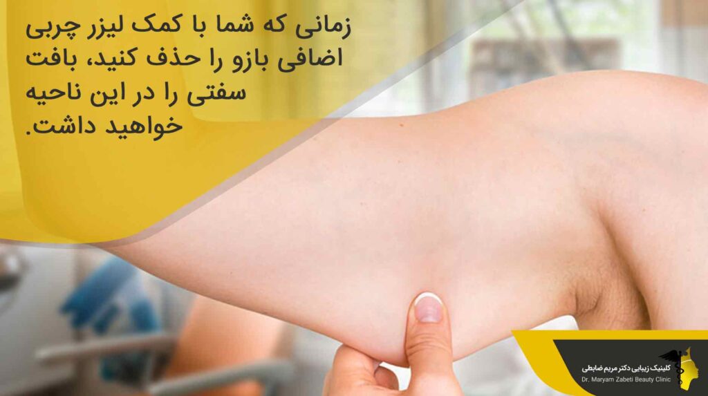 مزایای شگفت انگیز لیفت بازو با لیزر 