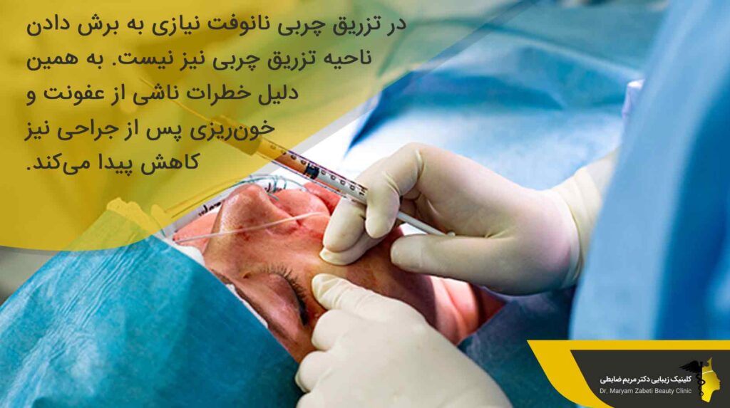 آیا جراحی تزریق چربی نانوفت ایمن است؟