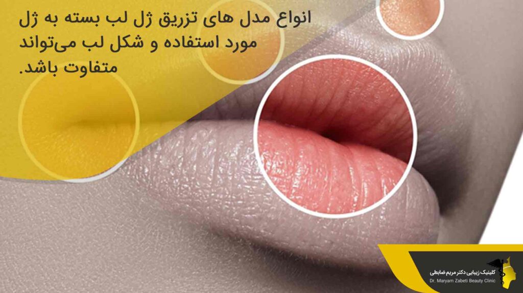 انواع مدل ژل لب