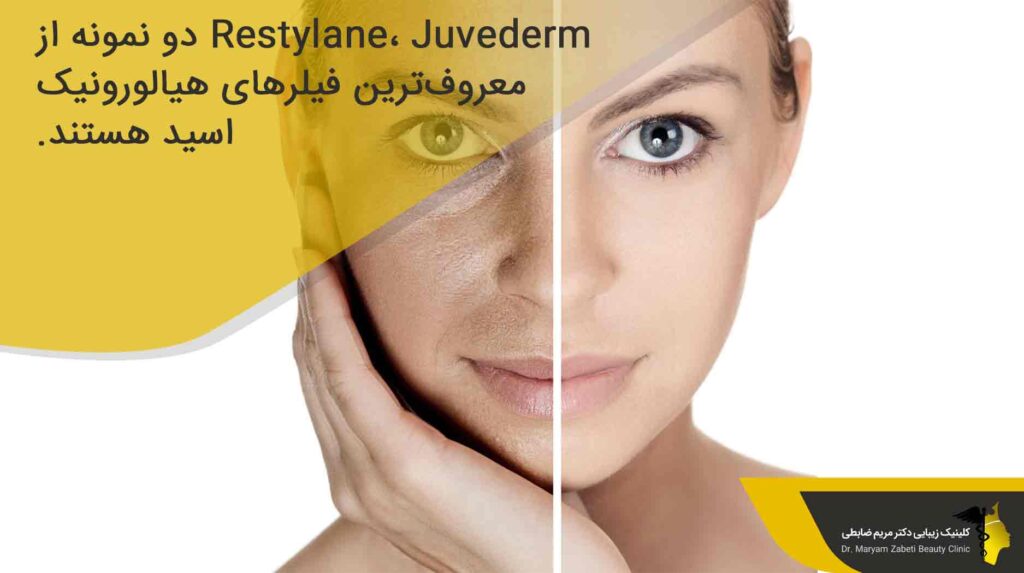 انواع ژل های تزریقی صورت