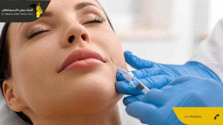 تزریق ژل خط خنده