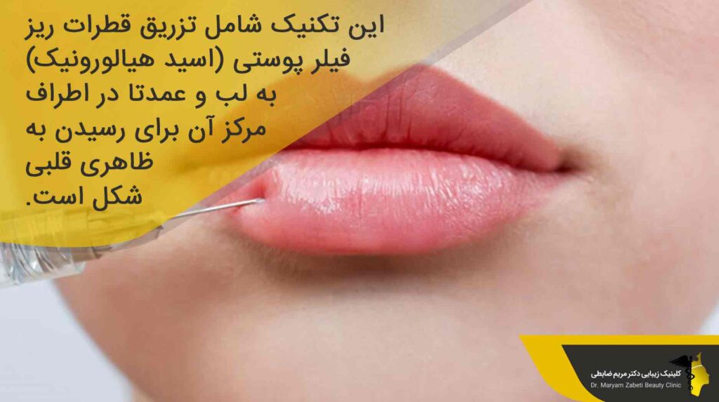 تکنیک لب عروسکی چگونه انجام می‌شود؟