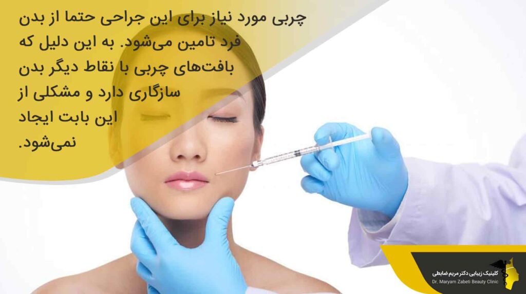جراحی تزریق چربی به خط خنده
