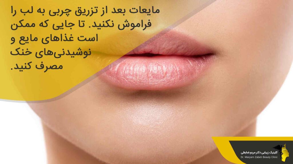 مراقبت‌ها بعد از تزریق چربی به لب
