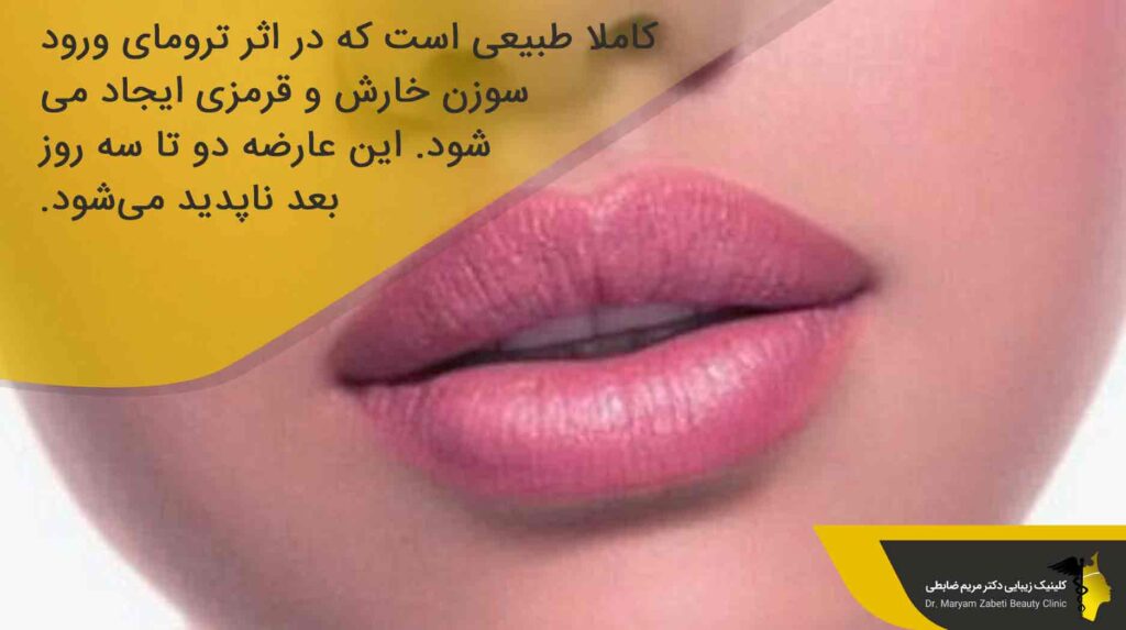 عوارض انواع تزریق ژل لب