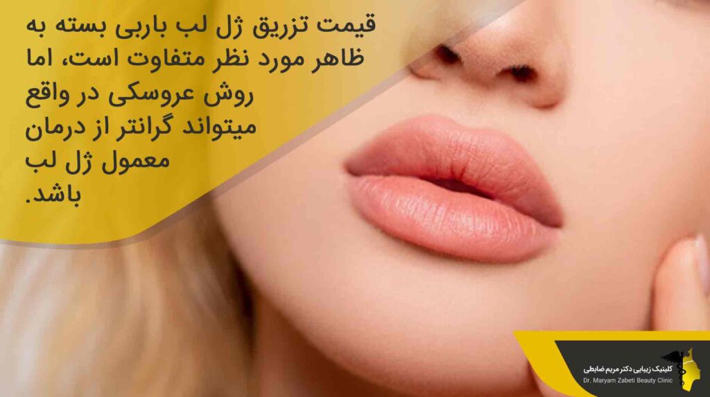 قیمت تزریق ژل لب مدل عروسکی