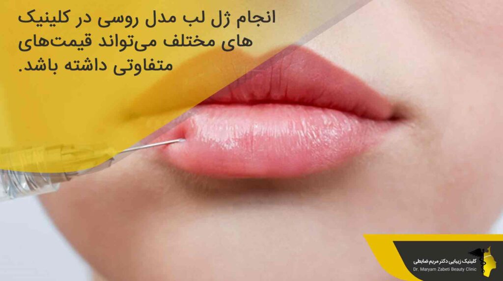 قیمت ژل لب مدل روسی